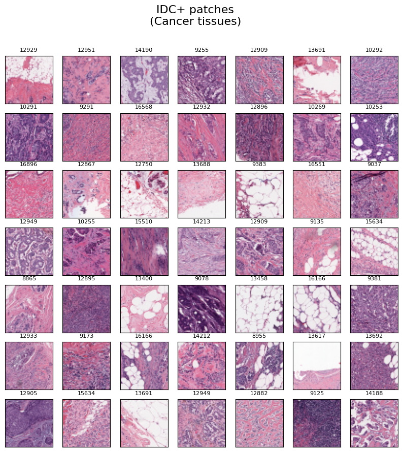 Random samples of cancer tissues.png