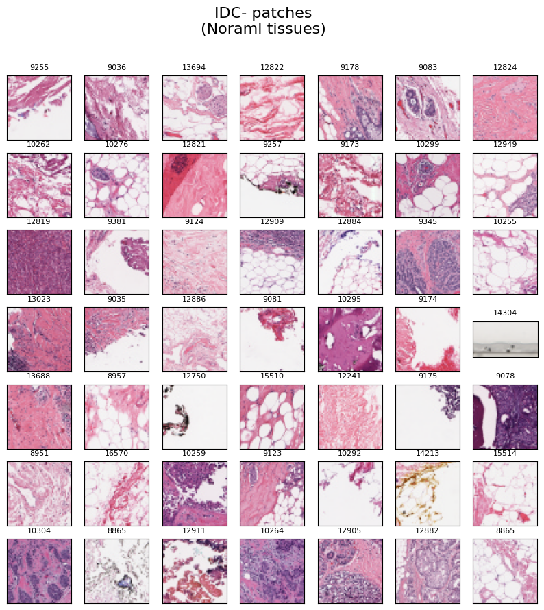 Random samples of healthy tissues.png